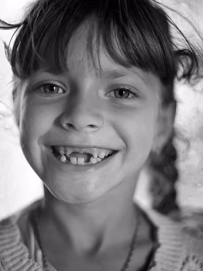 Black and white close-up of a child smiling with a missing front tooth